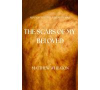 The Scars of my Beloved
