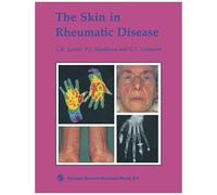 The Skin In Rheumatic Disease