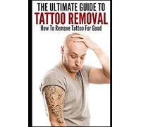 The Ultimate Guide To Tattoo Removal: How To Remove Tattoo For Good