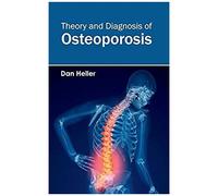 Theory And Diagnosis Of Osteoporosis