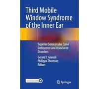 Syndrome 3e fenêtre mobile de l'oreille interne – Déhiscence du canal semi-circulaire supérieur