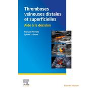 Thromboses veineuses distales et superficielles Aide à la décision - François Minvielle - Elsevier Masson - broché - Scolaire / Universitaire