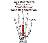 Tissue Engineering, Therapy And Applications Of Bone Regeneration