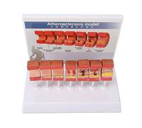 Tixiyu Modèle D'anatomie des Artères, Ensemble éducatif de 7 Pièces, Simulation Réaliste pour étudiants en Médecine, Matériau en PVC