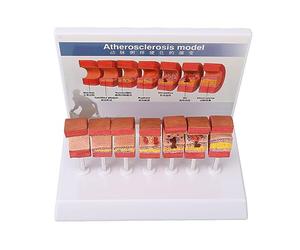 Tixiyu Modèle D'anatomie des Artères, Ensemble éducatif de 7 Pièces, Simulation Réaliste pour étudiants en Médecine, Matériau en PVC