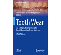 Tooth Wear: An Authoritative Reference for Dental Professionals and Students