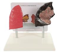 TOPBATHY 1Pc Modèle Anatomique Pulmonaire Comparaison De Poumon Fumeur pour l'enseignement Et L'Éducation Médicale Caractéristiques Pathologiques Réalistes pour La Formation en