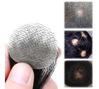 Toupet de Patch de cheveux de tache chauve, unité de remplacement de cheveux naturels de cheveux humains pour la ligne de cheveux d'hommes et de femmes(Black,2cm)