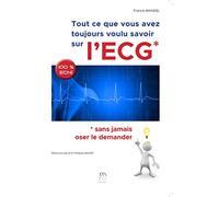 Tout ce que vous avez toujours voulu savoir sur l'ECG sans jamais oser le demander