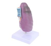 TOYZFRIENDY Modèle Pulmonaire Pathologique et Réaliste pour Enseignement Médical Anatomie Respiratoire avec Détails Précis Outil Pédagogique pour Étudiants