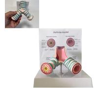 TQPGJJL Modèle Professionnel De Démonstration De L'asthme 3D - Voies Respiratoires Bronchiques avec Tableau Bilingue pour éducation Médecin-Patient, Formation Clinique + Cabinet Médical