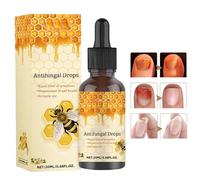 Traitement Des Champignons À Ongles - 20 Ml De Champignon Effectif L'ongle | Adoucisseur Réparateur Le Renforcement Adapté La Réparation Endommagés Et Promotion Croissance Saine