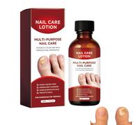 Traitement des ongles des orteils, formule douce, améliore efficacement les ongles pour un look plus beau