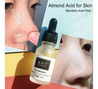 Transformez Votre Peau Avec Le Miracle De L'acide D'amande,La Solution Ultime Pour Une Élimination Brillante Et Saine Des Points Noirs Au Xion Abaissé