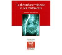 Transfusion Sanguine - Une Approche Sécuritaire