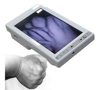 Transilluminateur de veine Infrarouge Portable,LED Vein Finder Détecteur de veine Portable Infrarouge pour Les infirmières cliniciennes pédiatriques