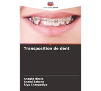 Transposition de dent