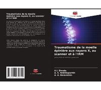 Traumatisme De La Moelle Épinière Aux Rayons X, Au Scanner Et À L'irm