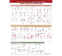 Travell, Simons & Simons Trigger Point Pain Patterns Wall Chart: Trunk, Pelvis, and Lower Limb