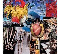 TRICHOMONIASIS - HARVEST OF THE KILLING FIELDS