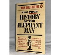 True History of the Elephant Man
