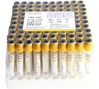 Tubes de prélèvement sanguin sous vide de laboratoire avec gel de séparation et coagulant pour une meilleure visibilité dans l'échantillonnage