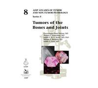 Tumors Of The Bones And Joints