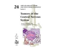 Tumors of the Central Nervous System