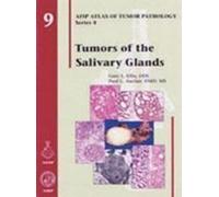 Tumors Of The Salivary Glands