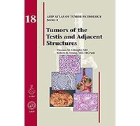 Tumors Of The Testis And Adjacent Structures