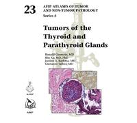 Tumors of the Thyroid and Parathyroid Glands