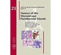 Tumors of the Thyroid Glands