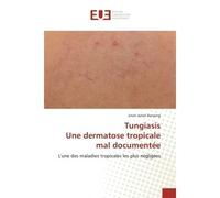 TungiasisUne dermatose tropicale mal documentée L'une des maladies tropicales les plus négligées - Jinoh Jamet Banjong - Universitaires Europeennes - broché - Livre