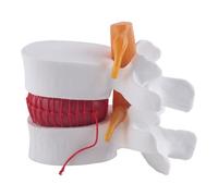 Ujjdwiurgh Anatomie humaine squelette colonne vertébrale disque lombaire hernie enseignement modèle cerveau crâne traumatique fournitures scolaires instrume