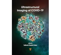Ultrastructural Imaging of Covid-19