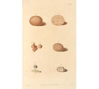Un essai sur l'histoire chimique et le traitement médical des troubles calculeux Pl.5 (1819) Affiche imprimée par Alexander Marcet (24 x 36)