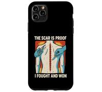 Un Patient en Chirurgie Que J'Ai combattu et Que J'Ai gagné Cool Mens Get Well Coque pour iPhone 11 Pro Max