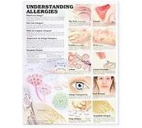 Understanding Allergies Anatomical Chart Anatomical Chart Company (Auteur)