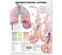 Understanding Asthma Anatomical Chart by Anatomical Chart Company Anatomical Chart Company (Auteur)