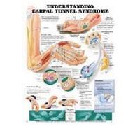 Understanding Carpal Tunnel Syndrome Anatomical Chart
