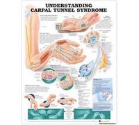 Understanding Carpal Tunnel Syndrome Anatomical Chart