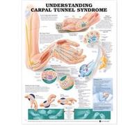 Understanding Carpal Tunnel Syndrome Anatomical Chart