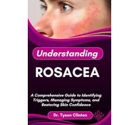 UNDERSTANDING ROSACEA: A Comprehensive Guide to Identifying Triggers, Managing Symptoms, and Restoring Skin Confidence