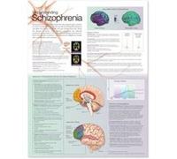 Understanding Schizophrenia Anatomical Chart by Anatomical Chart Company Anatomical Chart Company (Auteur)