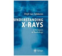 Understanding X-Rays