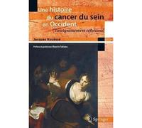 Une histoire du cancer du sein en Occident Enseignements et réflexions. - Jacques Rouëssé - Springer Vienne - Poche - Scolaire / Universitaire