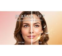 Une séance de Plasma lift pour une zone au choix (ride du lion ou foxy eyes)