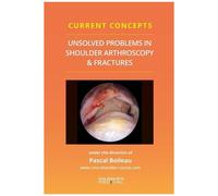 Unsolved Problems In Shoulder Arthroscopy & Fractures - Tome 1