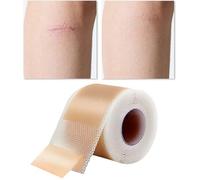 Uoqpty Ruban en silicone pour cicatrices, patchs de cicatrices - Ruban de réparation de la peau pour jambes, mains, bras, cou, soins quotidiens pour femmes, hommes, adultes, adolescents, personnes