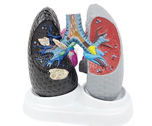 UPIKIT Poumon Fumeur Modèle de poumon sain, poumon respiratoire et bronches Aides didactiques Théorie respiratoire viscérale Humaine Démonstration Comparative